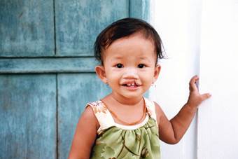 Foto: Operation smile Leende barn med gomspalt